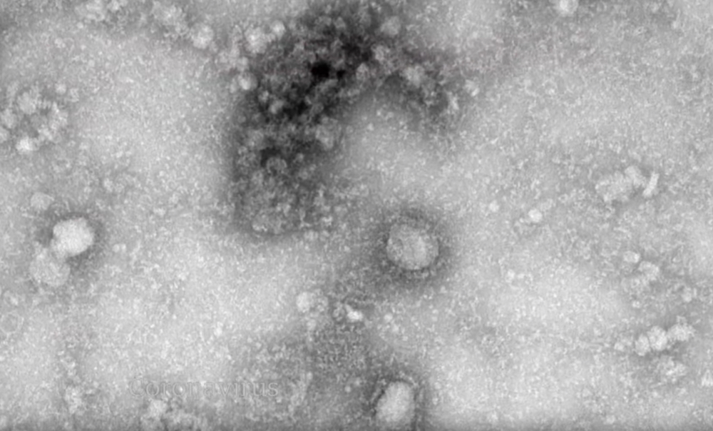 Covid-19 cuts $280bn swathe through top 50 stage.mining.companies