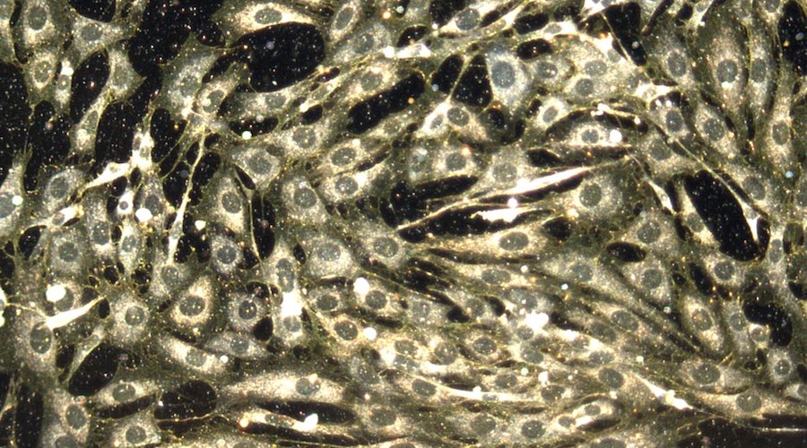 Implantable gold sensor can help monitor vital values, drug effectiveness