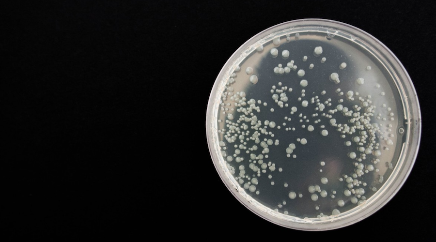 Scientists want to engineer bacteria to sustainability mine rare earths