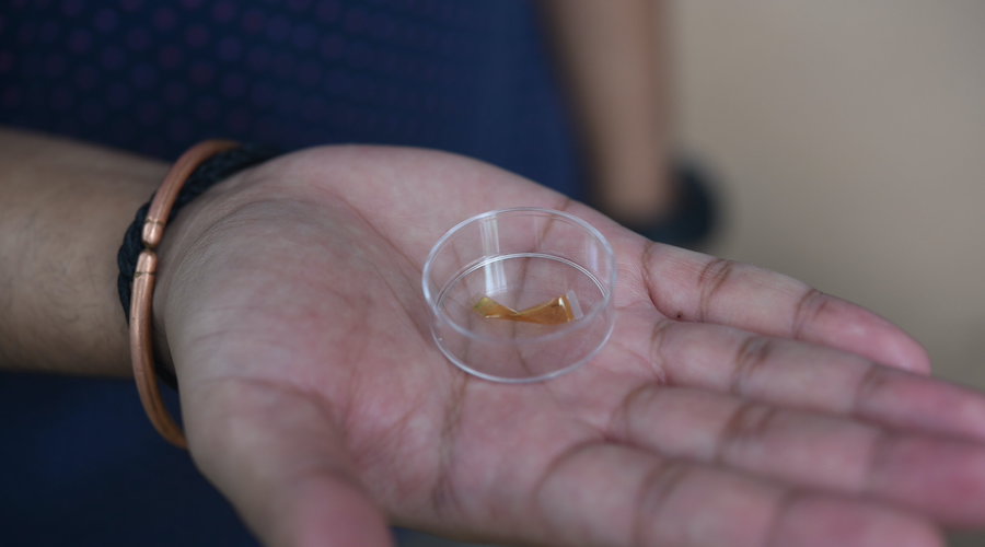 Flexible gold sensor may become game-changer for body glucose monitoring