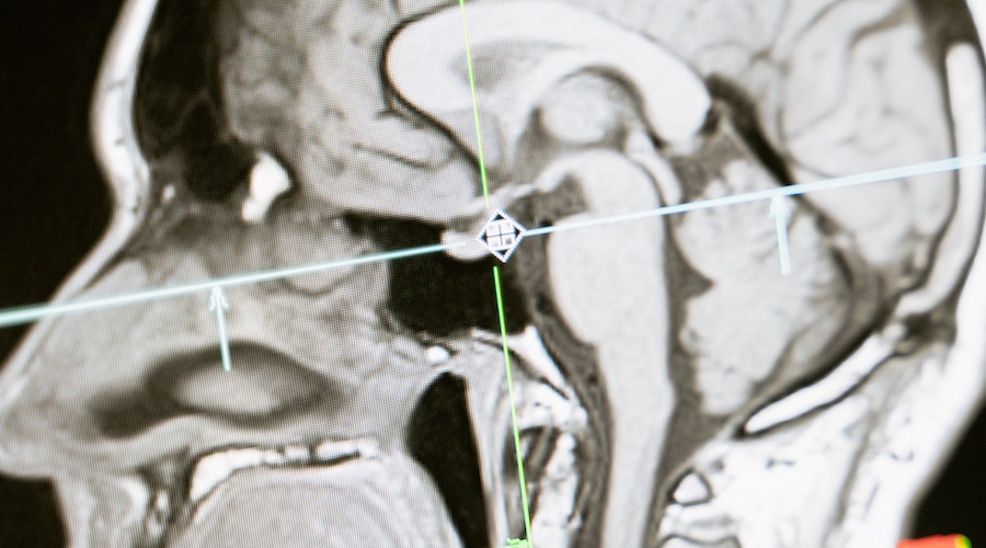 Copper could now be used for clearer MRIs