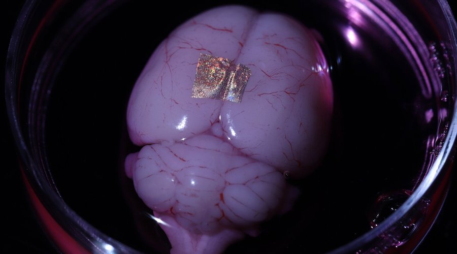Gold nanowire array on a rat brain.
