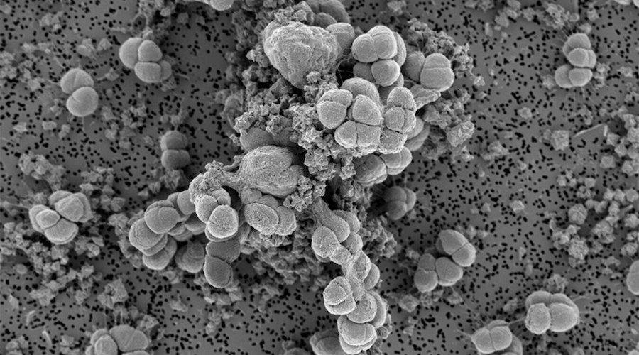 Ancient nickel-eating microbes can teach us valuable biomining techniques – study